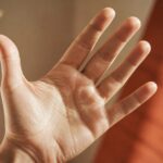 main gauche qui gratte - paume ouverte vue de face